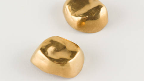 金歯